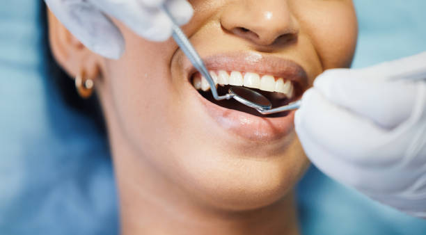 Best Broken or Chipped Tooth Repair in Liberty Corner, NJ