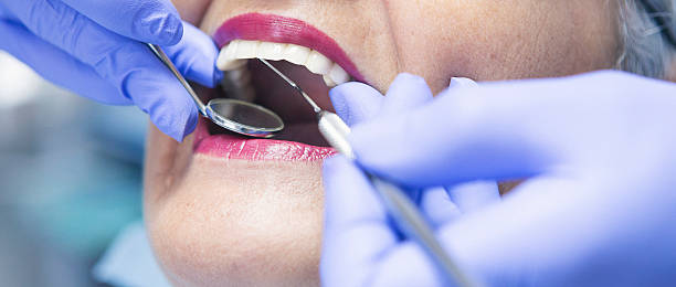 Best Emergency Wisdom Tooth Extraction in Liberty Corner, NJ